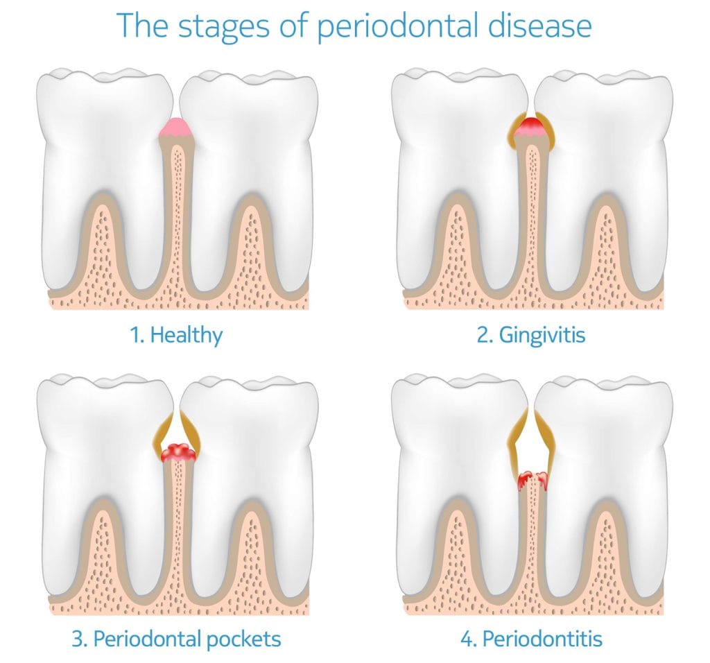 service-periodontics-01-1024×956