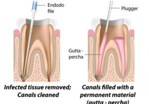 service-endodontics